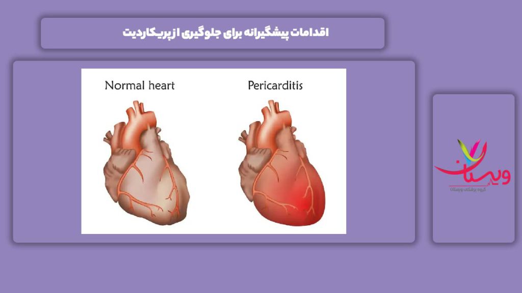 گامهای پیشگیرانه از این بیماری درمان پریکاردیت