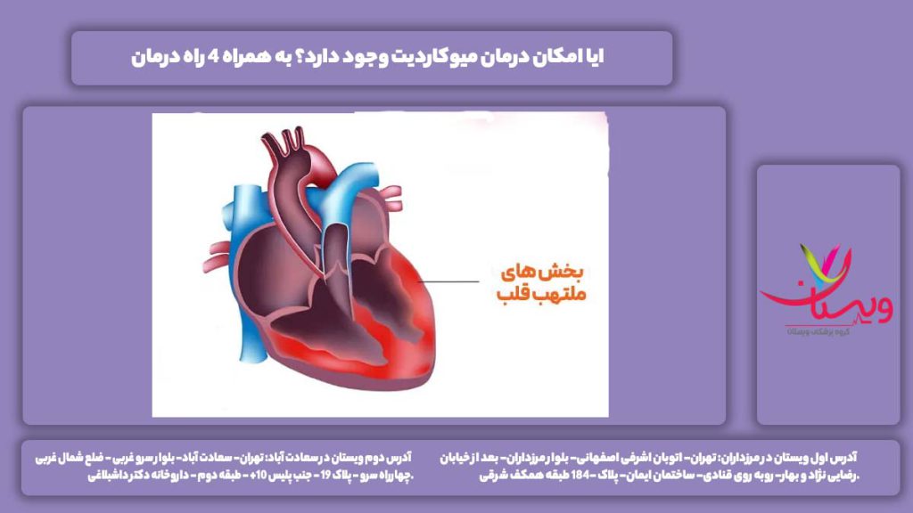 درمان میوکاردیت
