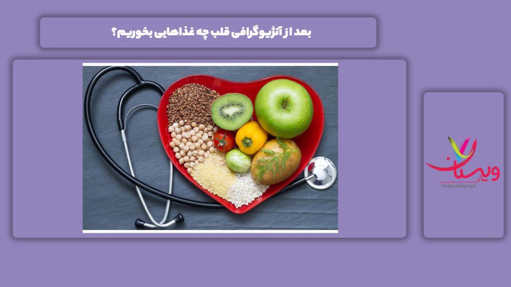 غذاهای مناسب برای بعد از آنژیوگرافی بعد از آنژیوگرافی قلب چه غذاهایی بخوریم؟