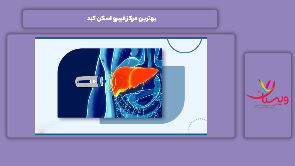 معرفی برترین مراکز فیبرو اسکن کبد بهترین مرکز فیبرو اسکن کبد