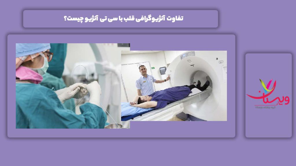 فرق آنژیوگرافی با اسکن هستهای تفاوت آنژیوگرافی قلب با اسکن هستهای چیست؟