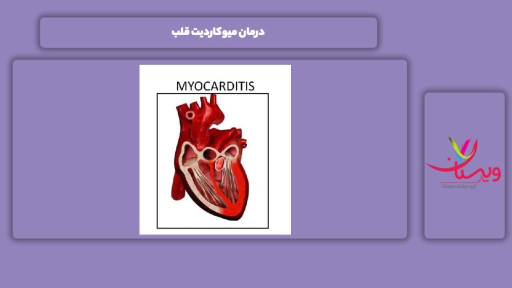 علاج و درمان این بیماری درمان میوکاردیت قلب
