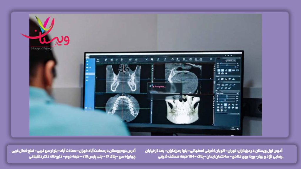 هزینه در مرکز ویستان هزینه سی تی آنژیو قلب در بهترین مرکز پزشکی تهران