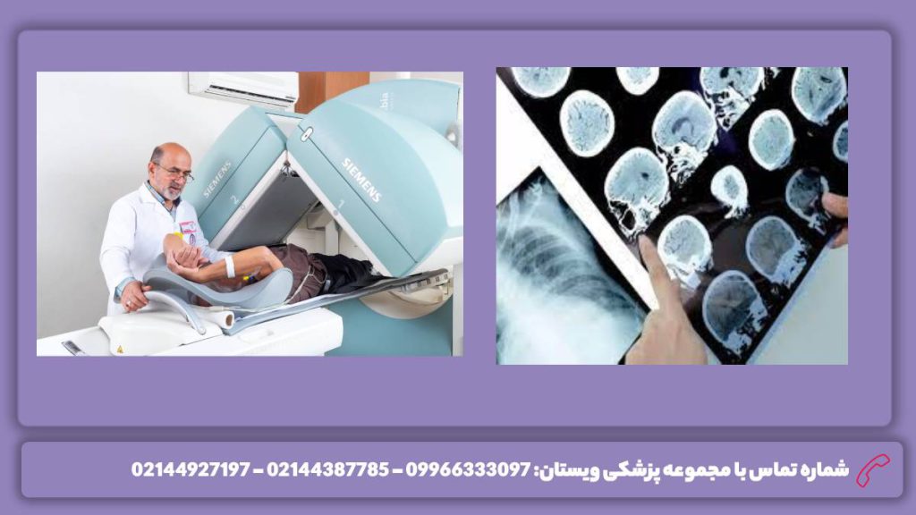 عوامل موثر در قیمت فاکتورهای مهم در هزینه پت اسکن