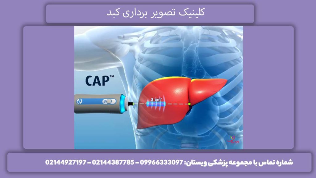 فیبرو اسکن در صادقیه تهران درمانگاه اسکن صادقیه