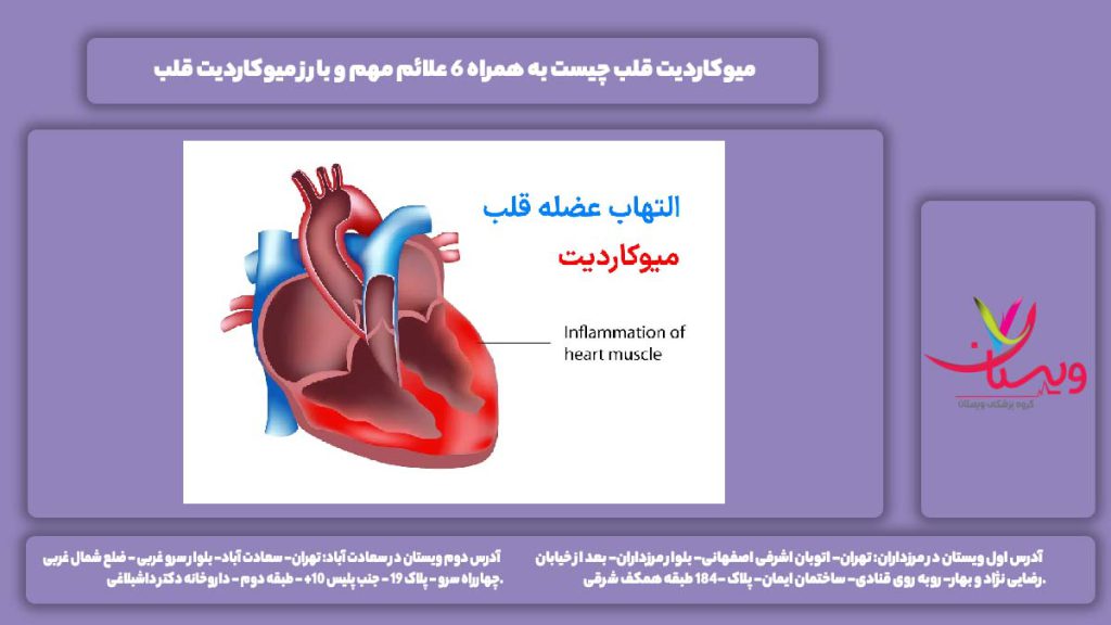 میوکاردیت قلب