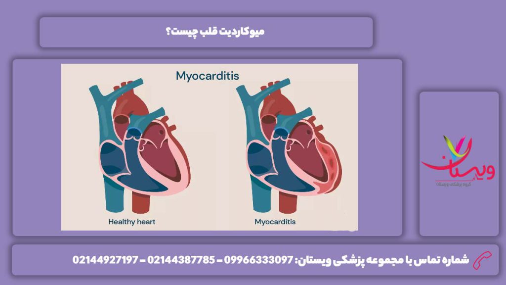 چیستی میوکاردیت میوکاردیت قلب