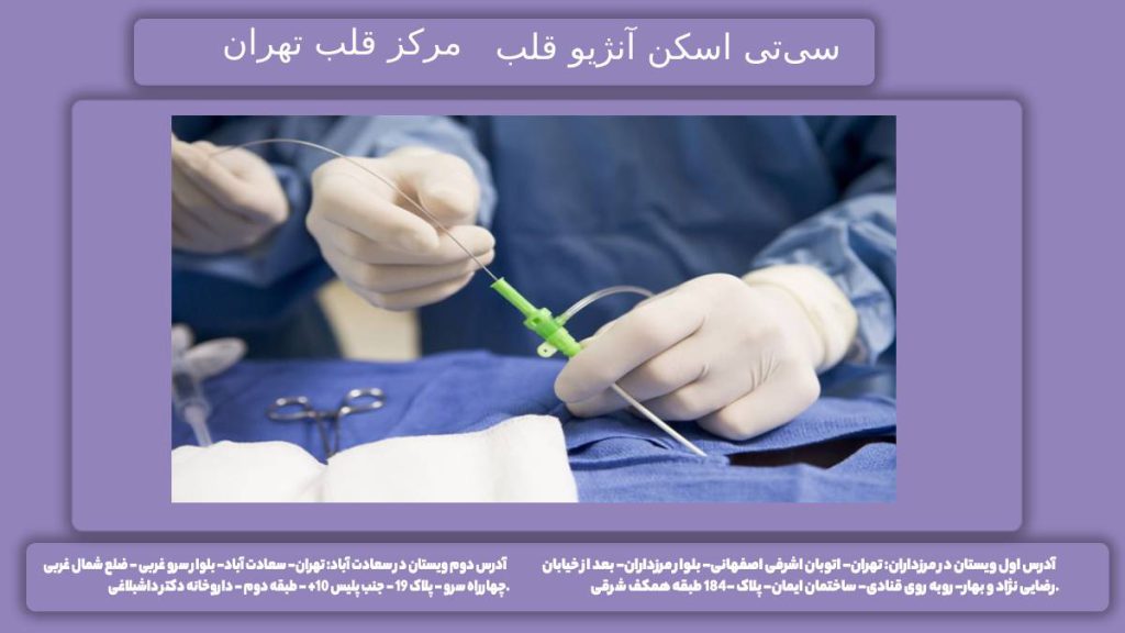 تعرفه در مرکز قلب تهران هزینه سی تی اسکن انژیو در مرکز قلب تهران