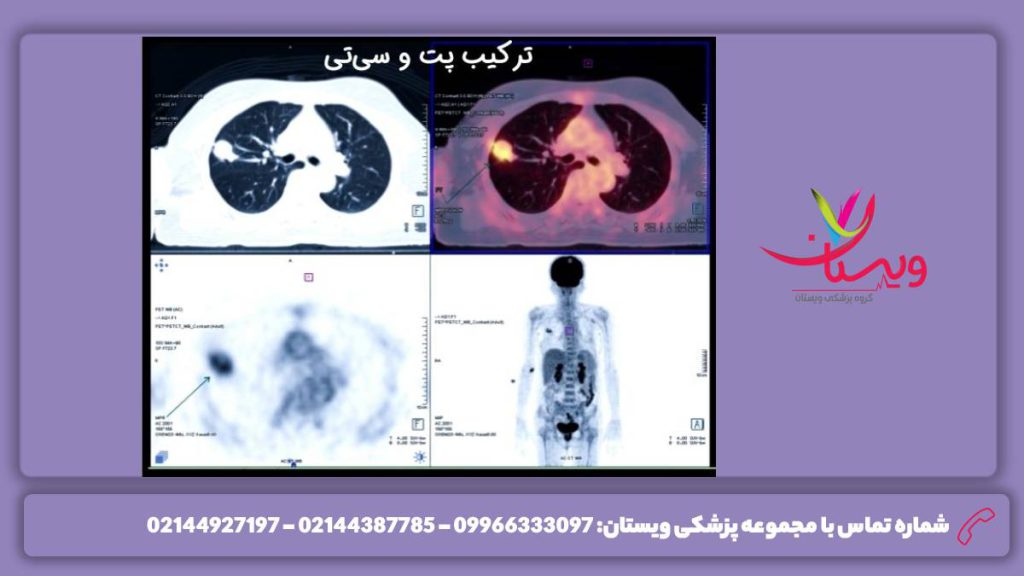 نرخ بیمارستان سینا در تهران مبلغ مشخص شده برای پت اسکن