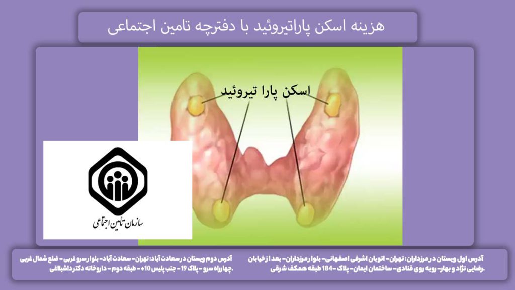 هزینه تست پاراتیروئید با اسکن