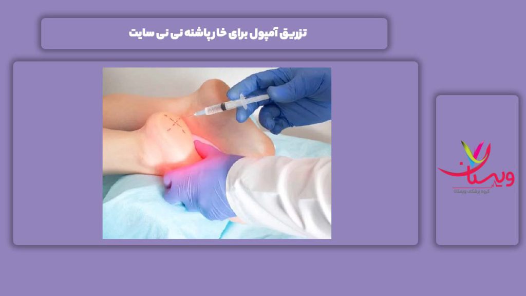 تزریق آمپول برای خار پاشنه نی نی سایت