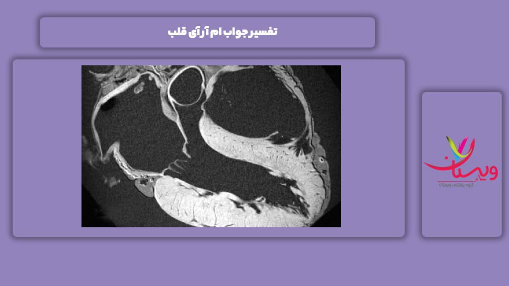 تفسیر جواب ام آر آی قلب