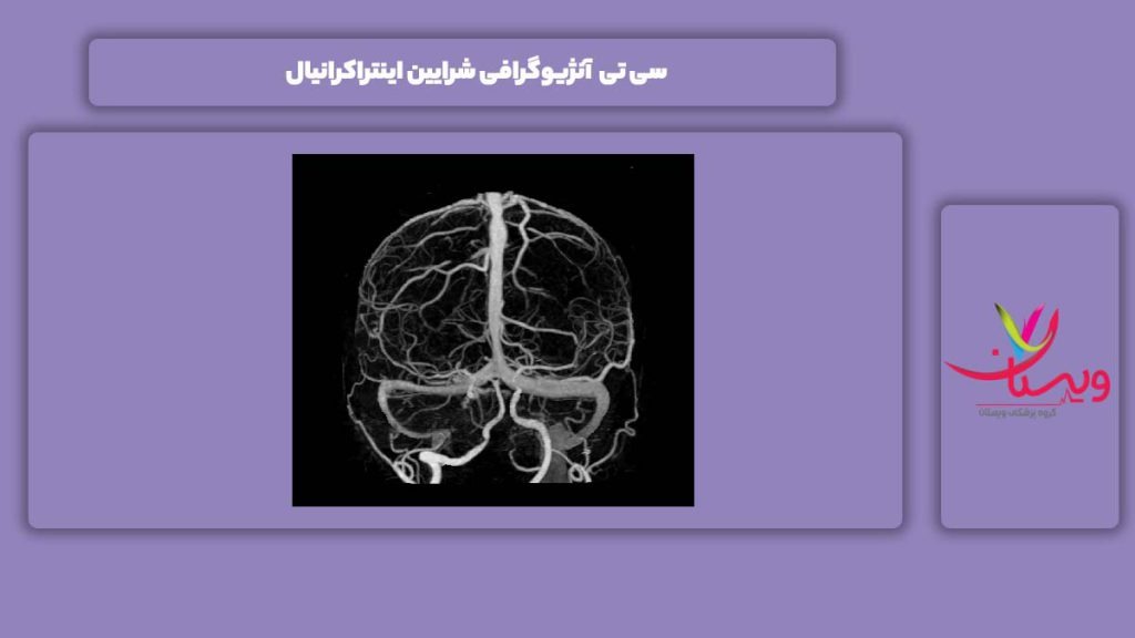 سی تی آنژیو شرایین اینتراکرانیال سی تی آنژیوگرافی شرایین اینتراکرانیال