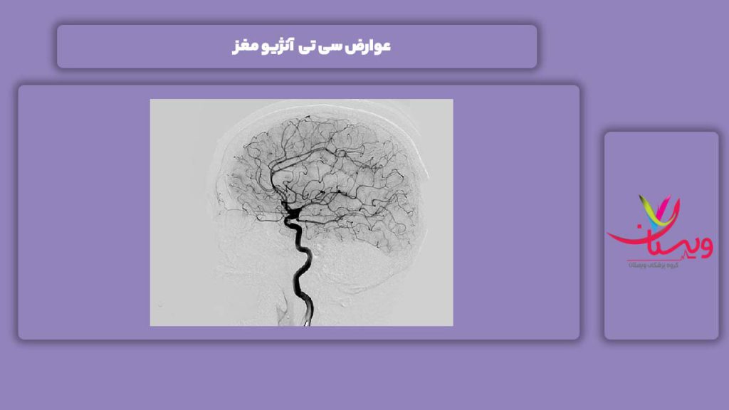 معایب انجام سی تی آنژیو مغزی عوارض سی تی آنژیو مغز
