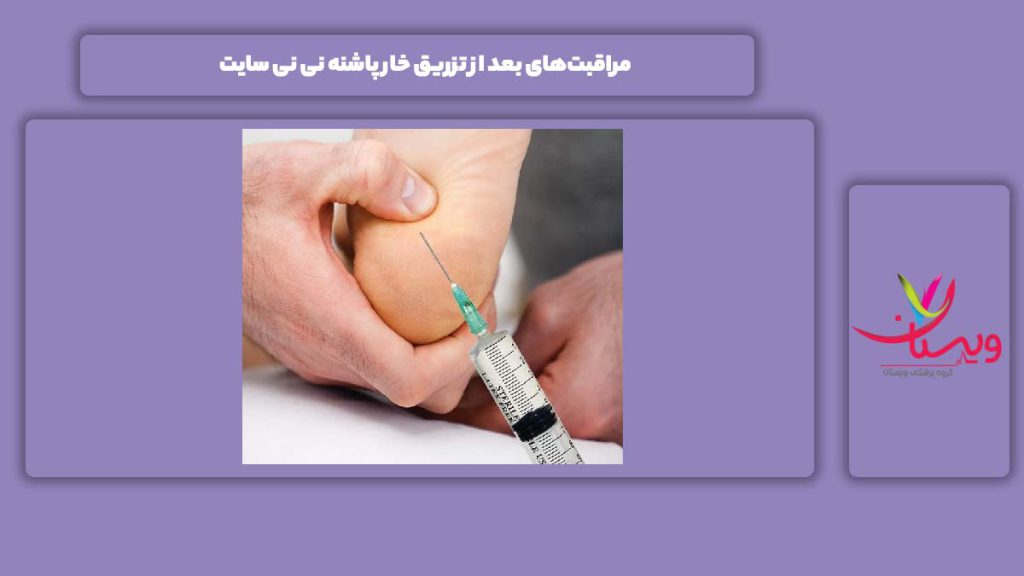 مراقبت‌های بعد از تزریق خار پاشنه نی نی سایت