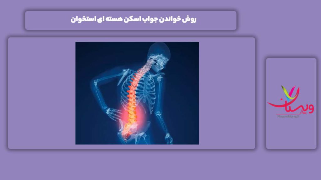 4 روش خواندن جواب اسکن هسته ای استخوان
