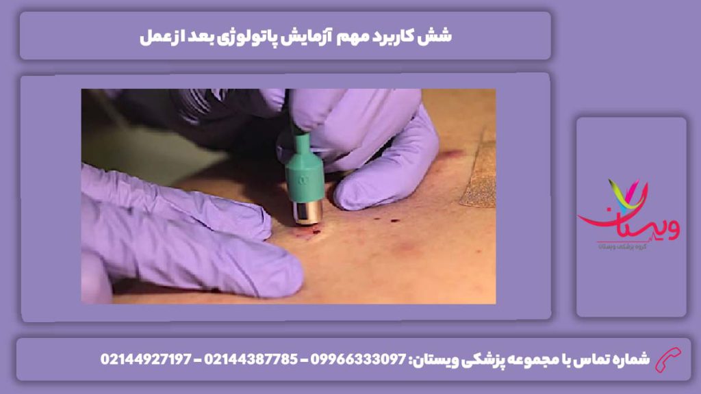 ویژگی پاتولوژی بعد از عمل آزمایش پاتولوژی چیست