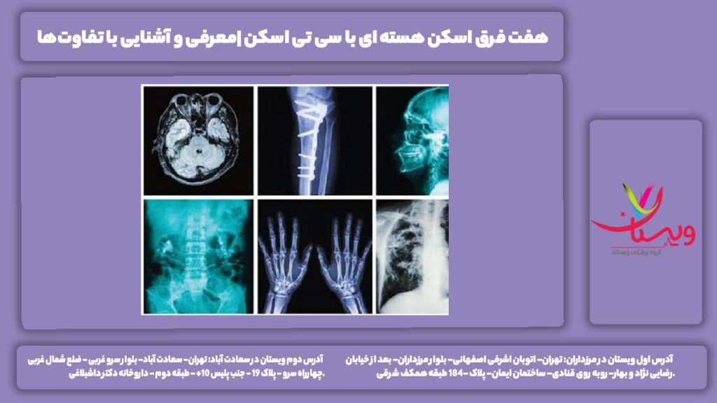 فرق اسکن هسته ای با سی تی اسکن