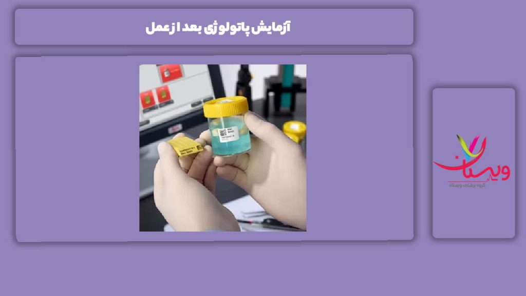 کاربرد پاتولوژی بعد از عمل آزمایش پاتولوژی بعد از عمل