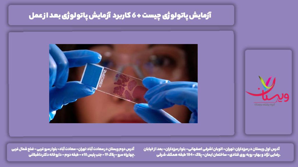 آزمایش پاتولوژی چیست