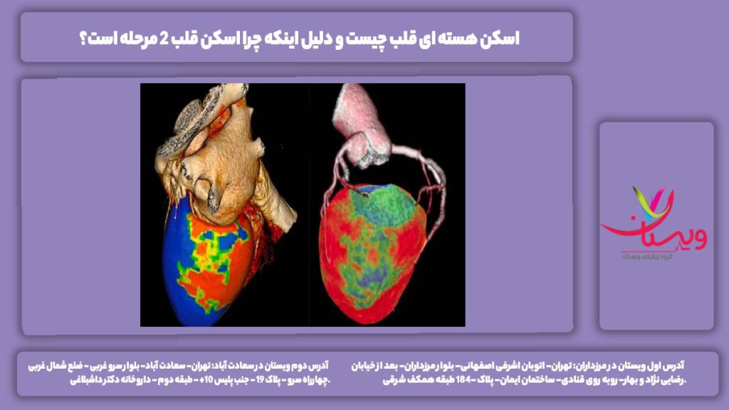 اسکن هسته ای قلب چیست