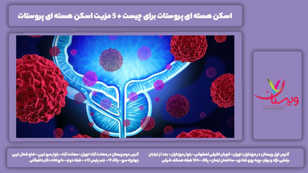 اسکن هسته ای پروستات