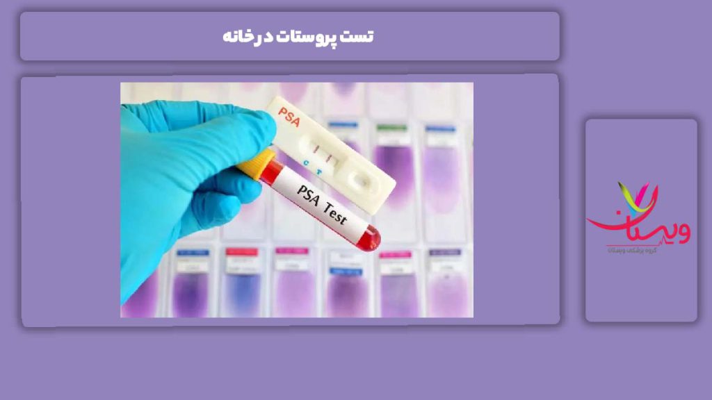 نحوه انجام تست پروستات در منزل تست پروستات در خانه