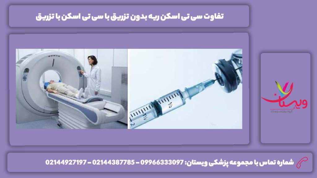 سی تی اسکن ریه بدون تزریق