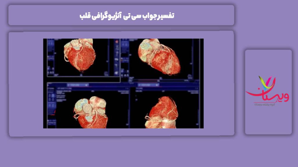 تفسیر جواب سی تی آنژیوگرافی قلب