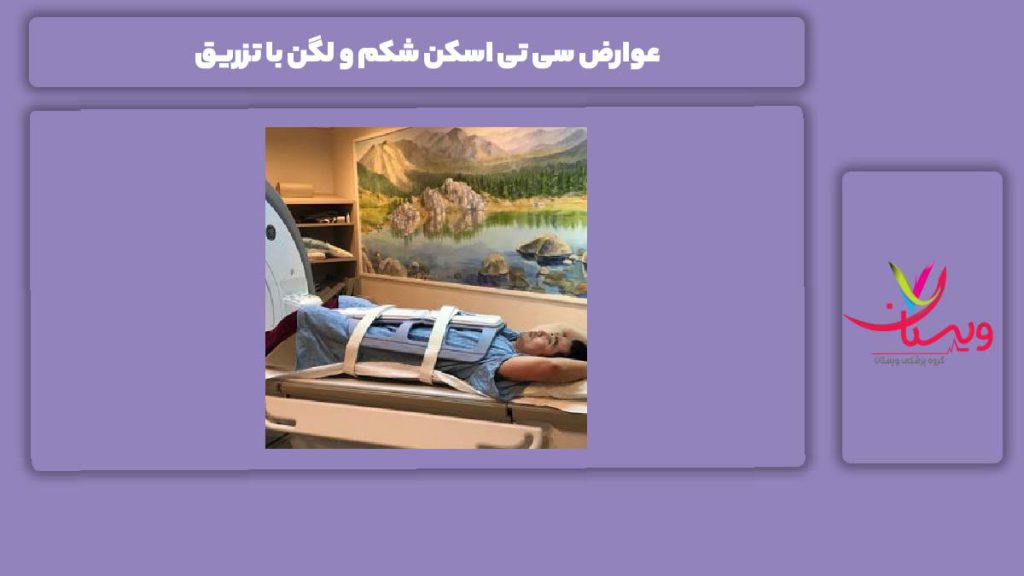 ضررهای سی تی اسکن شکم و لگن با تزریق عوارض سی تی اسکن شکم و لگن با تزریق