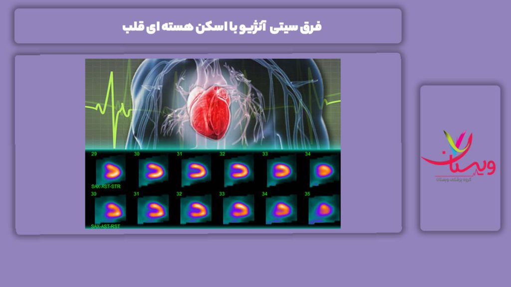تفاوت سیتی آنژیو با اسکن قلب فرق سیتی آنژیو با اسکن هسته ای قلب