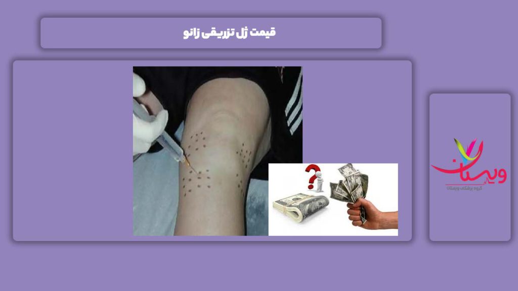 قیمت ژل تزریقی زانو