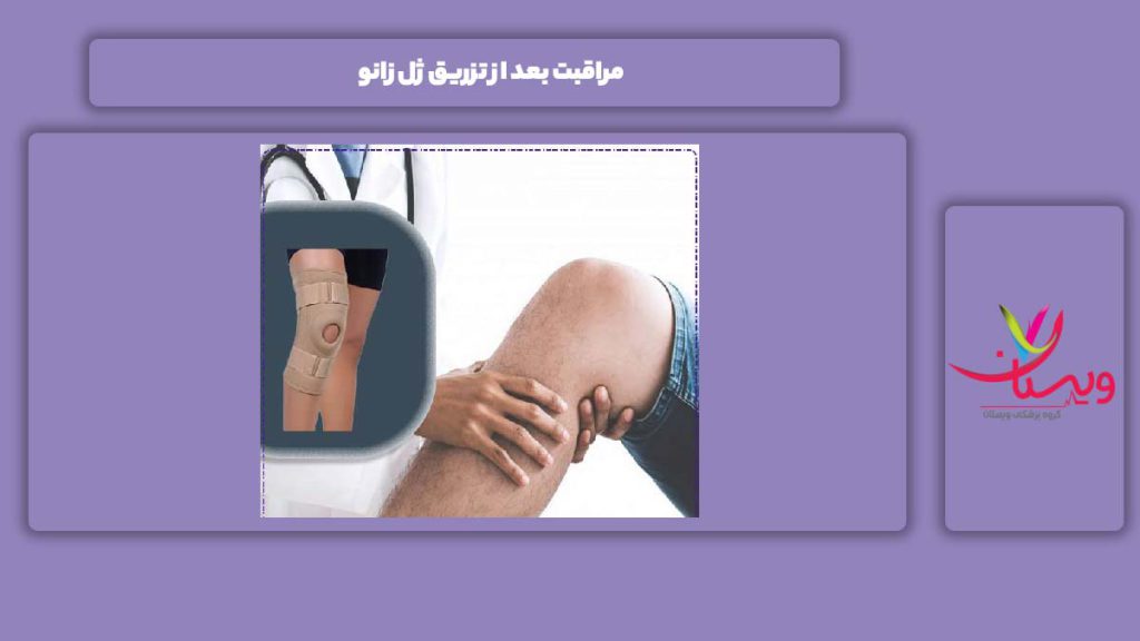 مراقبت بعد از تزریق ژل زانو