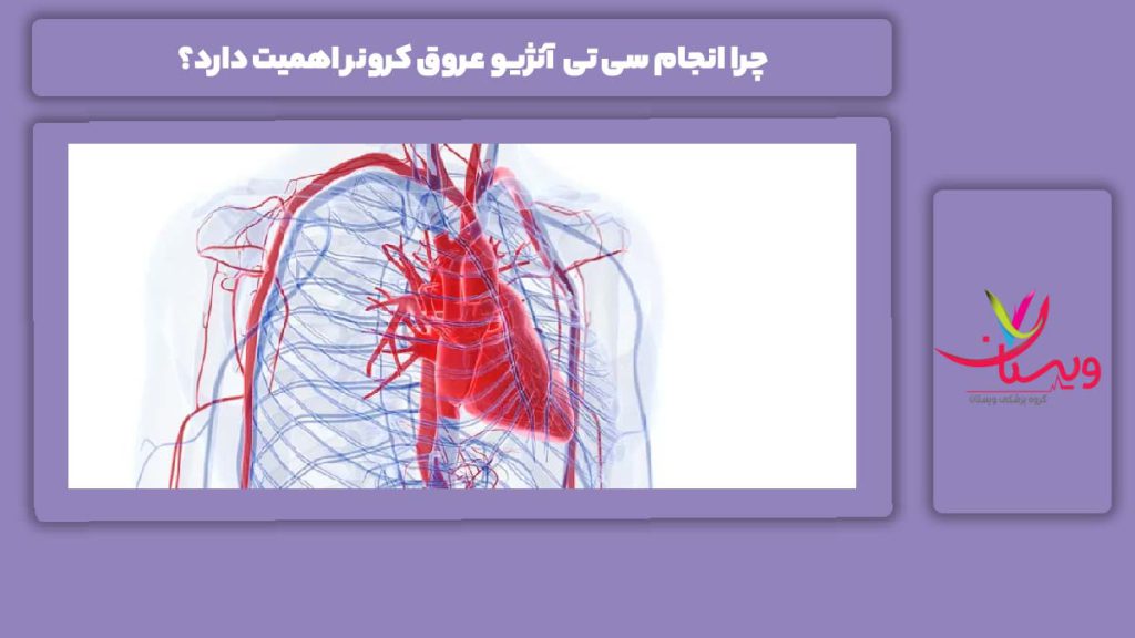 میزان اهمیت سی تی آنژیو عروق کرونیر چرا انجام سی تی آنژیو عروق کرونر اهمیت دارد؟