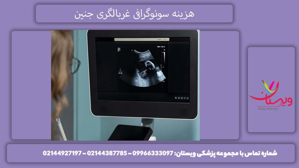 هزینه سونو آنومالی 1404 چقدر است؟