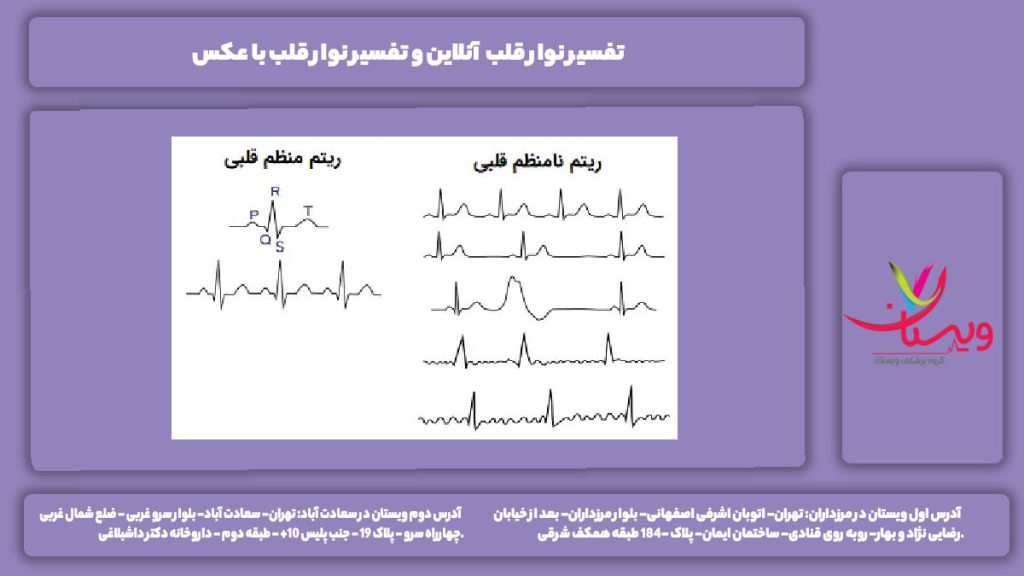 تفسیر نوار قلب آنلاین