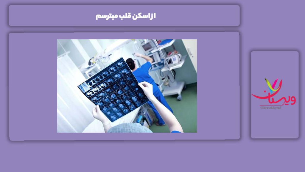 اقدامات قبل از عکس رنگی قلب