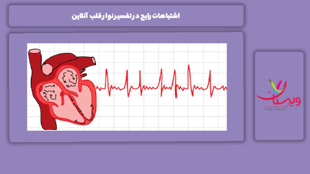 اشتباهات رایج در تفسیر نوار قلب آنلاین