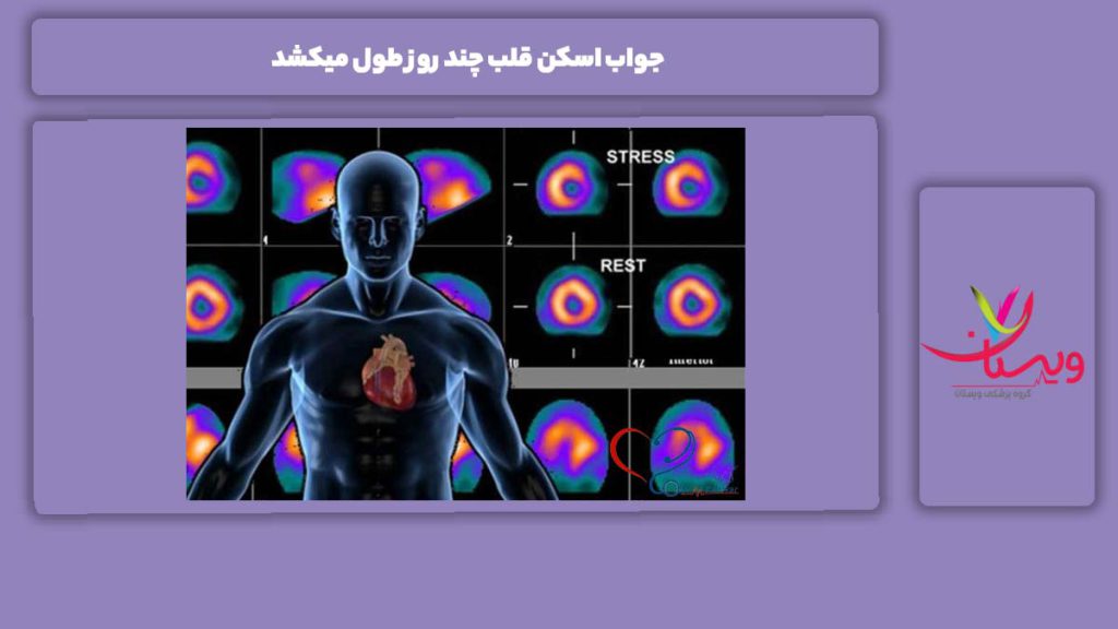 موارد قابل بررسی جواب اسکن قلب جواب اسکن قلب چند روز طول میکشد