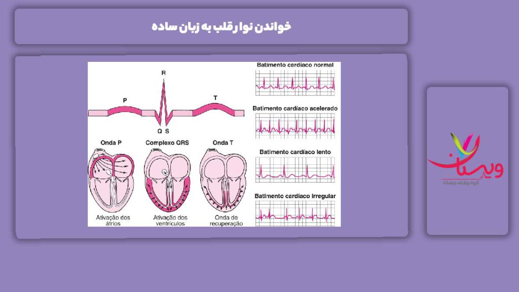 خواندن نوار قلب به زبان ساده