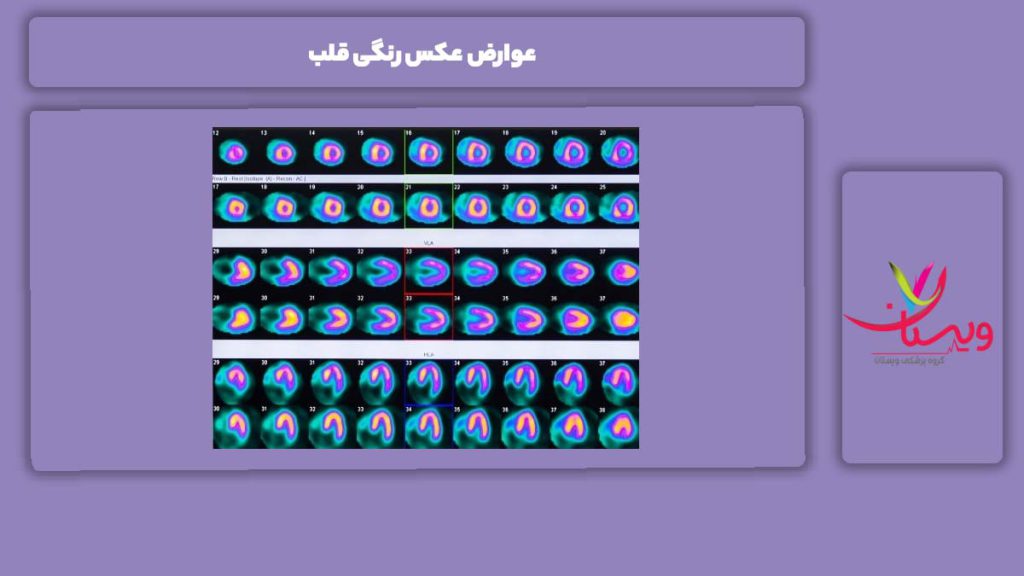 عوارض عکس رنگی قلب