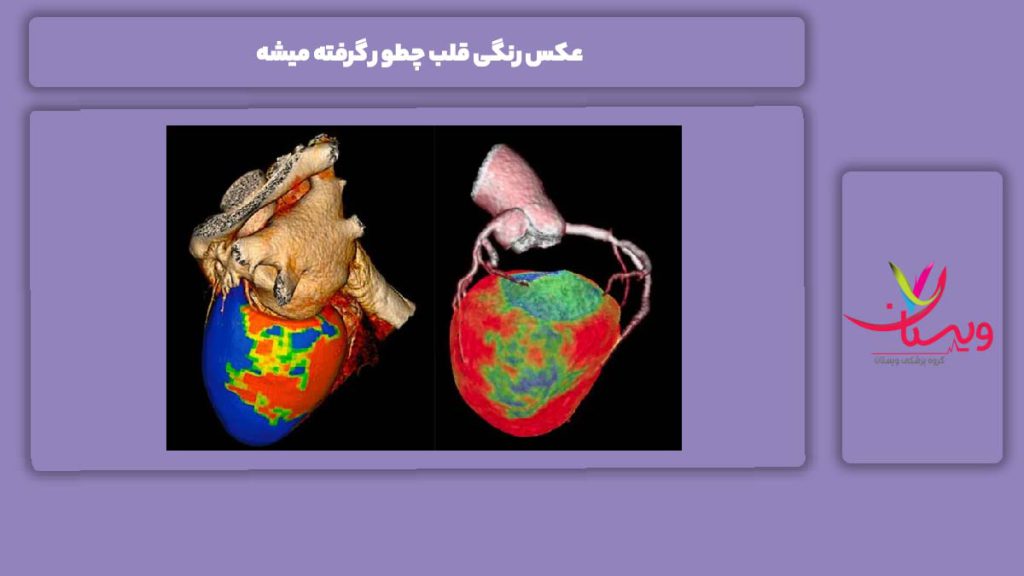 عکس رنگی قلب چطور گرفته میشه