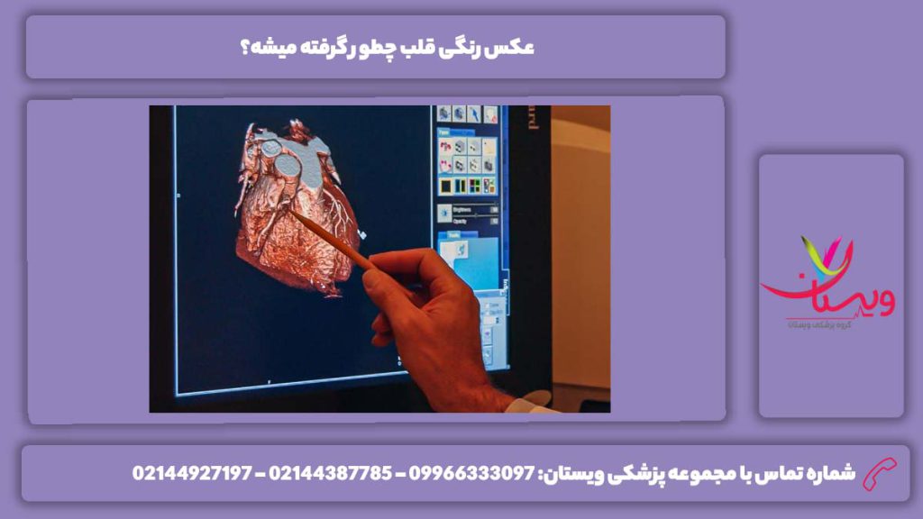 مراحل انجام اسکن قلب عوارض عکس رنگی قلب