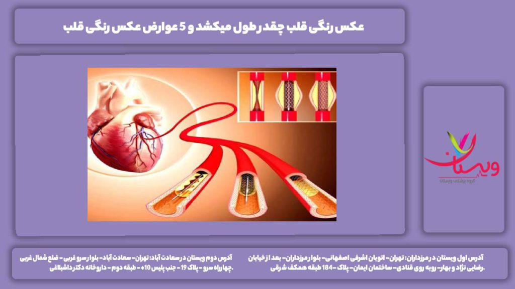 عکس رنگی قلب چقدر طول میکشد