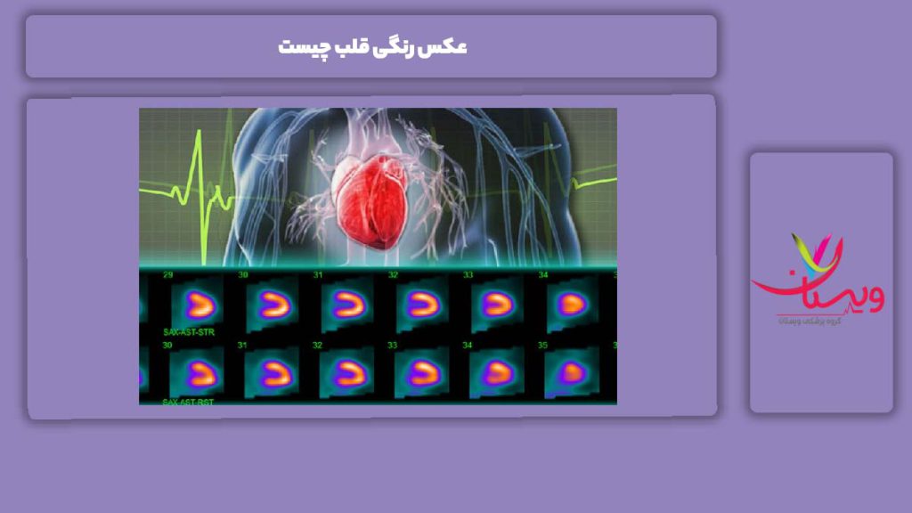 عکس رنگی قلب چیست