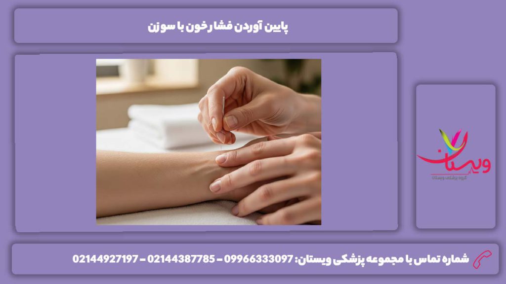 پایین آوردن فشار خون با سوزن