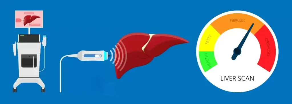 فیبرواسکن چگونه انجام می شود فیبرواسکن چگونه انجام می شود