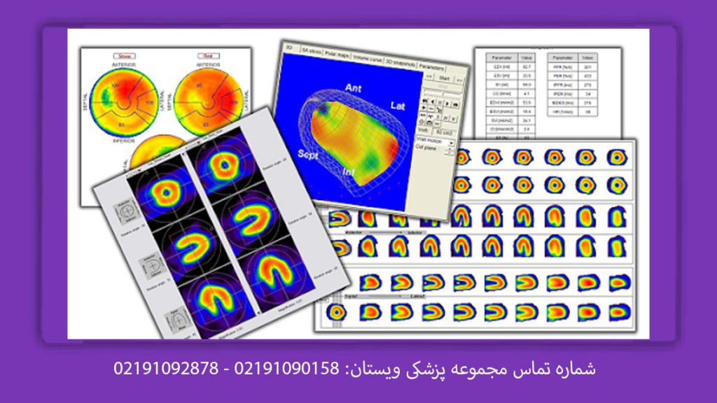 چگونگی تحلیل نتیجه اسکن قلب