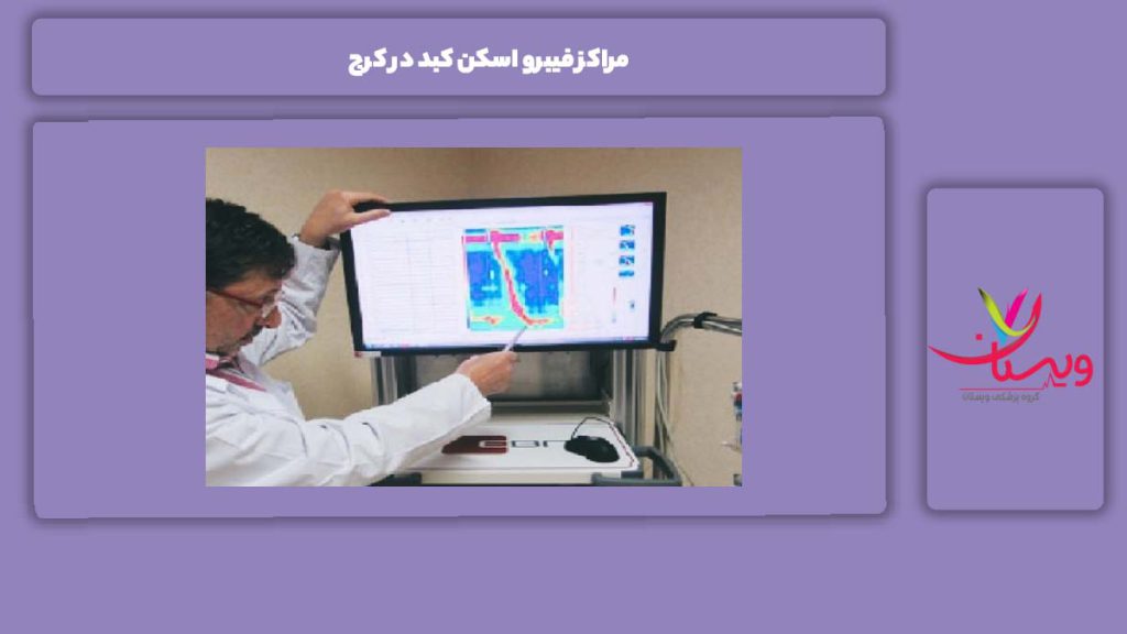 مراکز فیبرو اسکن کبد در کرج