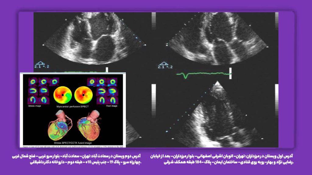 تحلیل نتیجه اسکن قلب و گرفتگی رگ